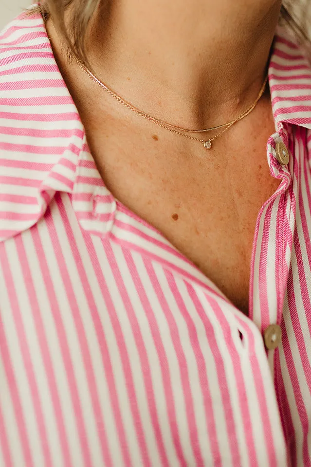 Oversized Striped Button Up Shirt